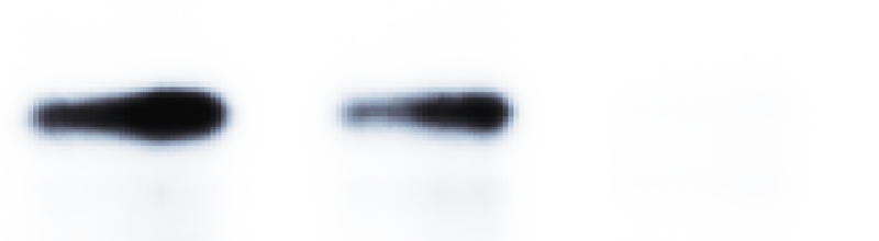 A close-up of a Western blot with two visible lanes showing protein bands at the same approximate height. The contrast has been increased so that the bands sit on a white background.