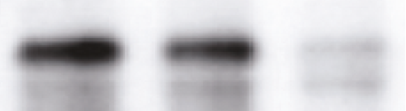 The same close-up of a Western blot as previously shown. Now the contrast has been restored so that much more information is visible. The bands sit on grey backgrounds and there is a third lane, faintly visible.