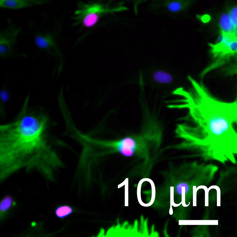 Microscopic image with a clearly defined scale bar and label.